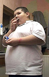 British mother to be deprived of parental rights for having extremely overweight son