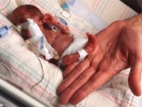 1 in 15 premature babies die. 47052.jpeg