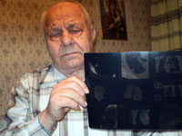 Man Lives With Bullet in His Lung for 68 Years