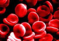 US FDA approves German blood plasma substitute Voluven