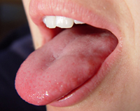 Stinky breath caused by 40,000 bacteria living on human tongue