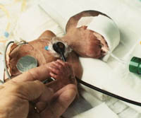 Healthy lungs for premature babies