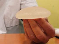 Thousands of French women recommended to get rid of their breast implants. 46234.jpeg