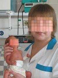 Nurse poses for camera holding preterm babies and posts pictures online