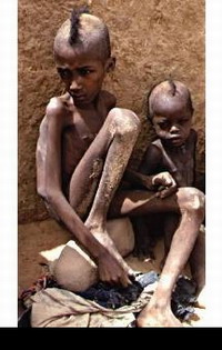 Malnutrition kills 6 million children annually