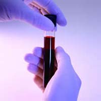New blood test may detect lung cancer early
