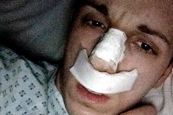 Man loses nose in bizarre incident in Chelyabinsk. 58347.jpeg