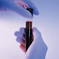 Stored blood may lack vital component