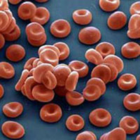 FDA takes extra time to approve new blood-thinner