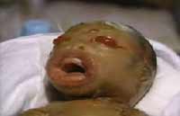 Woman gives birth to mutant baby in Malaysia