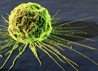Cancer to remain incurable even in 100 years