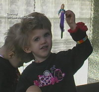 Doctors in Ohio to begin surgery on 3-year-old conjoined twins