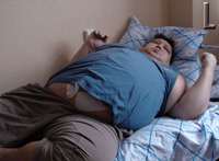 Man reduces his stomach to fight financial crisis