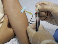18-month-old child receives HIV-positive blood during transfusion. 49852.jpeg