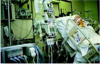 Children suffer from delusions and hallucinations while in paediatric intensive care unit