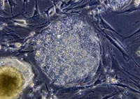 Embryonic stem cells created from unfertilized eggs, not embryos, scientists report