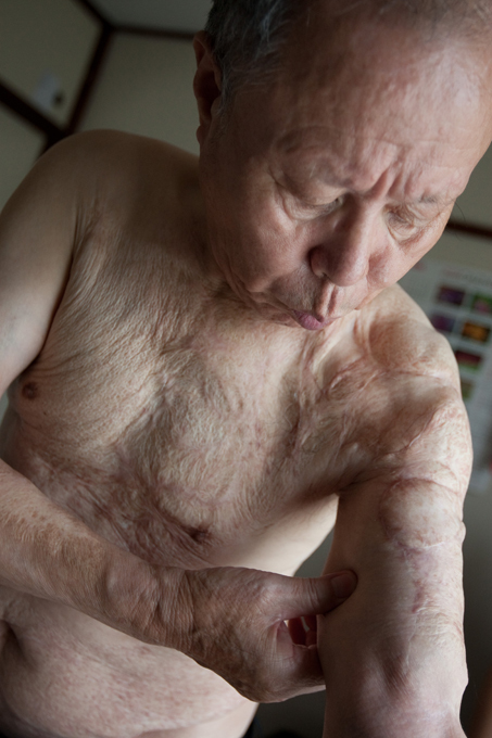 Hiroshima and Nagasaki: Hell on earth