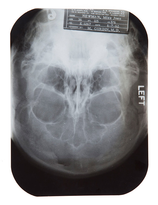 Marilyn Monroe's plastic secrets to be auctioned