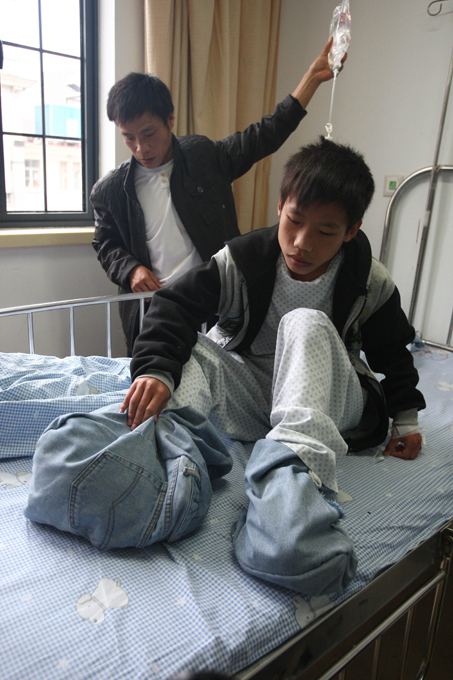 Hobbit boy with giant feet to receive surgery