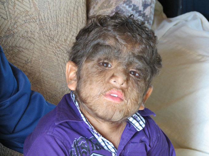 Most hairy family on Earth