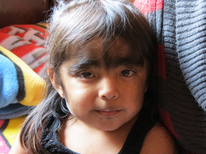 Most hairy family on Earth