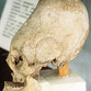 Strange egg-shaped skulls uncovered all over the world mystify scientists
