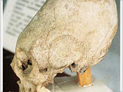 Strange egg-shaped skulls uncovered all over the world mystify scientists