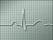 Heart attack incidence falls in men and grows in women