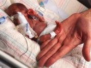 1 in 15 premature babies die