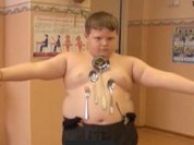 Electric shock turns Russian boy into Marvel's Magneto