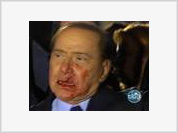 Berlusconi attack: Why did the wounds change sides?
