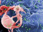 Thirty years of AIDS deadly triumph, still no hope