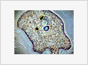 Six fatal cases related to brain-eating amoeba reported in USA