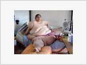 World’s fattest man to be operated on with extra large surgical tools