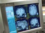 Urban life affects the human brain, says study