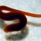 Patient prosecutes doctors who treated her brain-growth with leeches