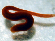 Patient prosecutes doctors who treated her brain-growth with leeches