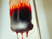 208 patients may have been infected with HIV through donor blood in Russia's Voronezh