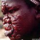 Chronic tropical diseases targeted by lethal mix: Medical science and the Pharma companies