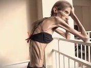 World's most anorexic woman dreams of motherhood