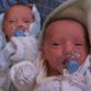 Identical twins: Most mysterious humans on Earth?