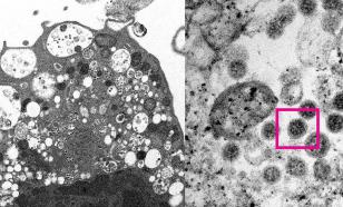 Two new coronavirus strains, including cerberus, identified in Russia