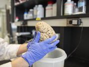 Iran launches world's first herbal medicine for Alzheimer's treatment