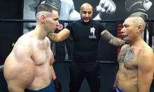 'Bazooka Arms' Blogger Battles Necrosis After Dangerous Body Modifications