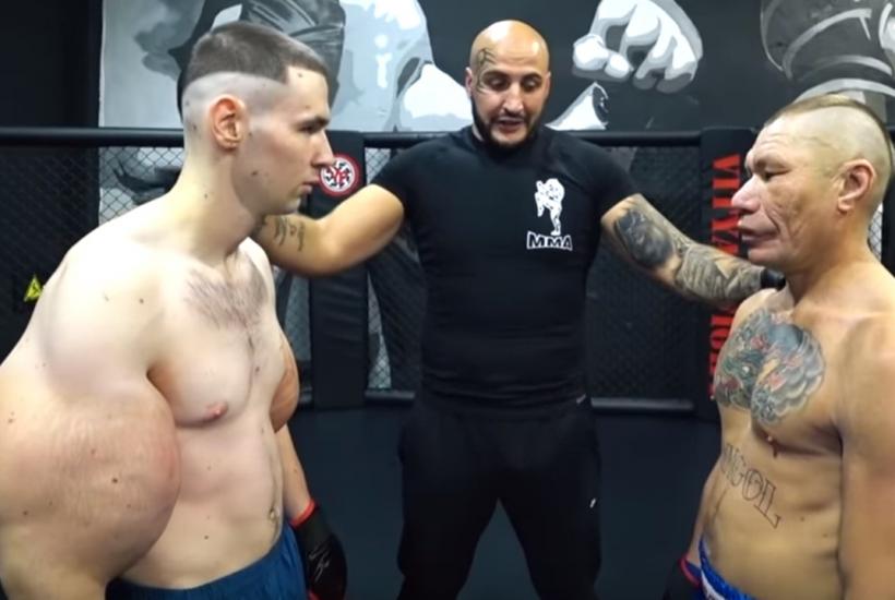 'Bazooka Arms' Blogger Battles Necrosis After Dangerous Body Modifications